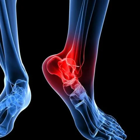 Ayak Bileği Hastalıkları