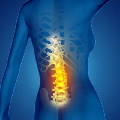 Bel Fıtığı: Nedir, Neden Oluşur ve Ameliyatsız Tedavi