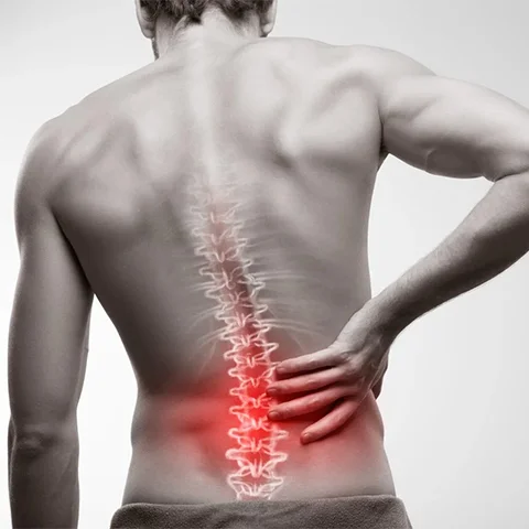 Bel Fıtığı Nedir?