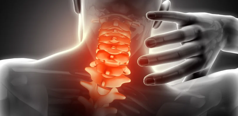 Boyun Kireçlenmesi Nedir? Belirtileri, Nedenleri ve Merak Edilenler