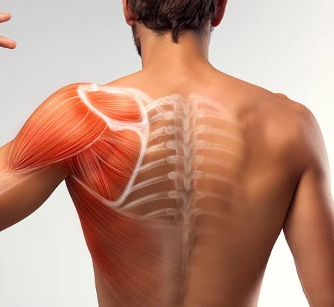 Donuk Omuz ve Tedavisi