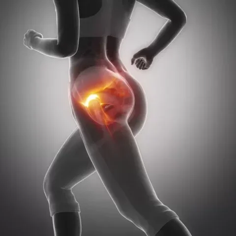 Kalça Hastalıkları